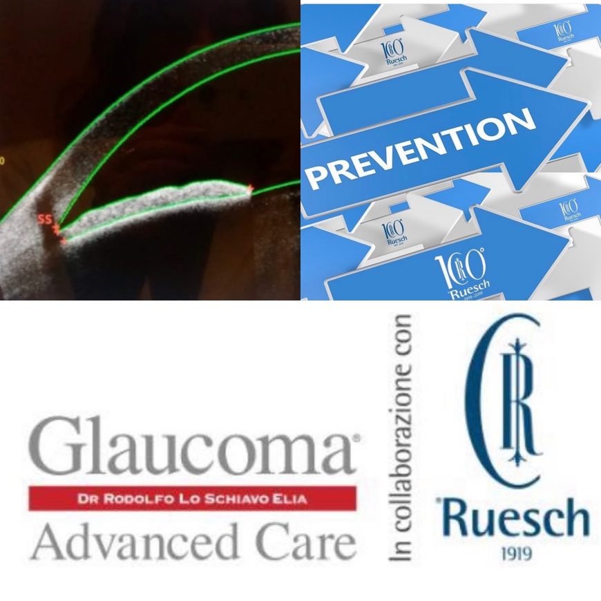 Glaucoma Advanced Care Napoli