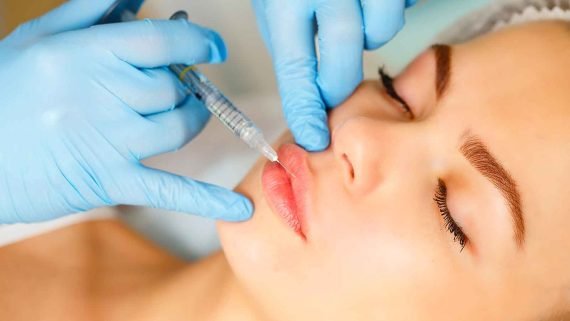 Filler Botox Napoli